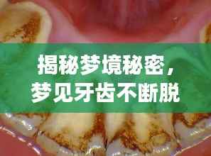 揭秘梦境秘密,梦见牙齿不断脱落的背后含义
